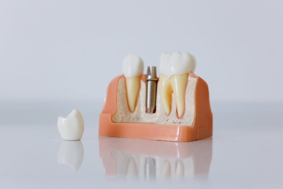 The Impact of Osteoporosis on Dental Implant Success Rates