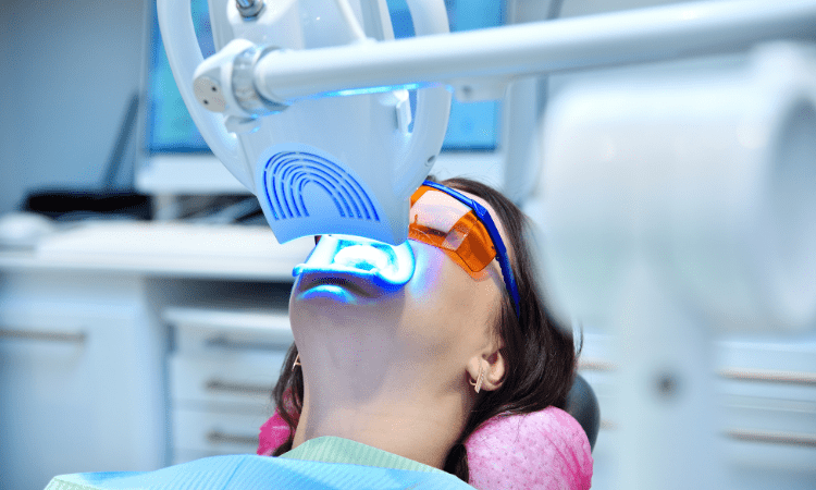 Professional teeth whitening has several benefits that make it a preferred choice for both aesthetics and safety.
