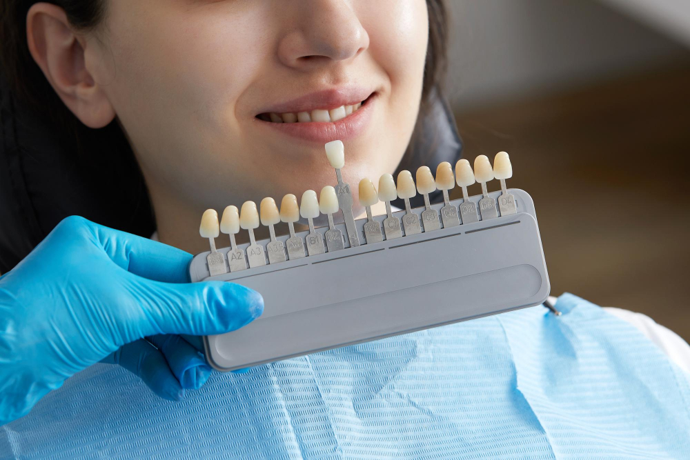 Understanding The True Cost Of Porcelain Veneers
